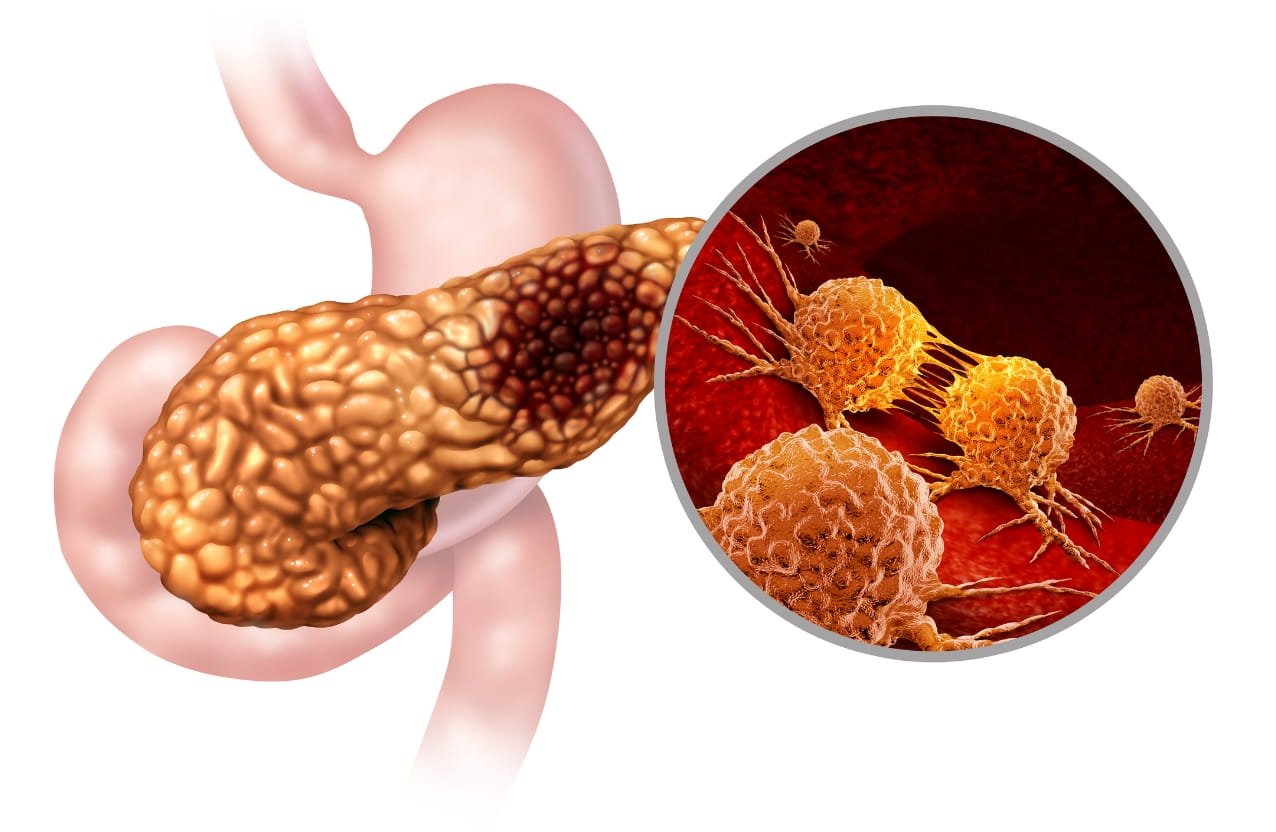 Biliary and Pancreatic Procedures